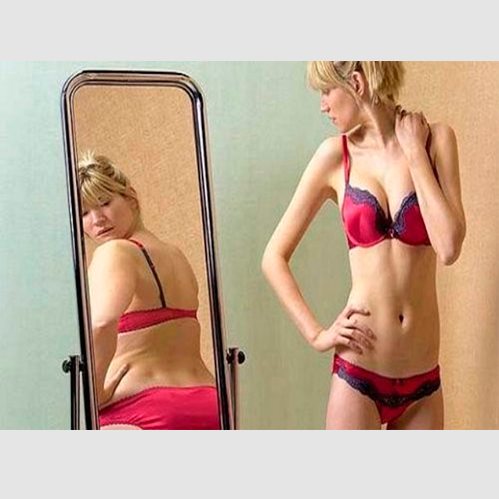 Anorexia: o que é, sintomas e tratamento