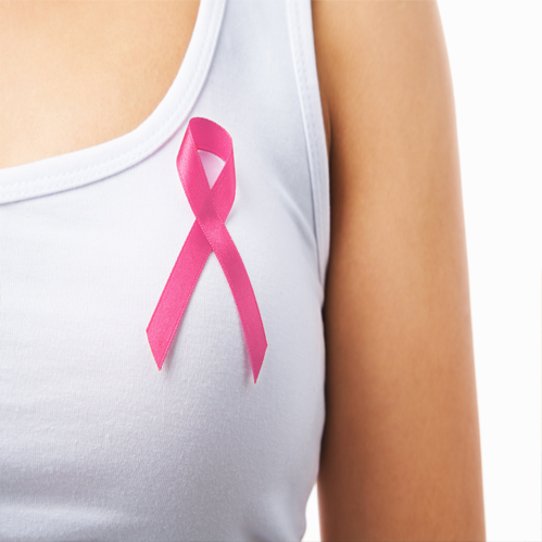Mitos sobre as causas do câncer de mama 