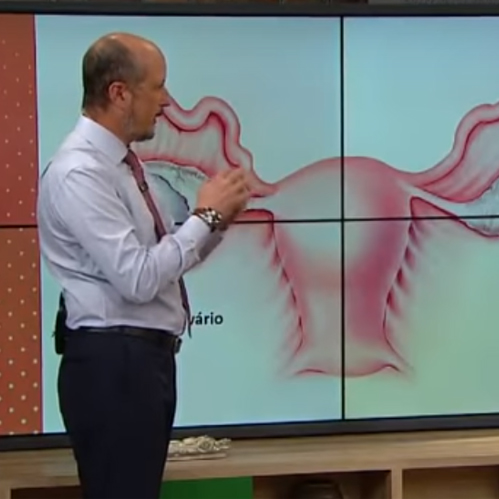 Vamos entender o que significa o cisto no ovário?