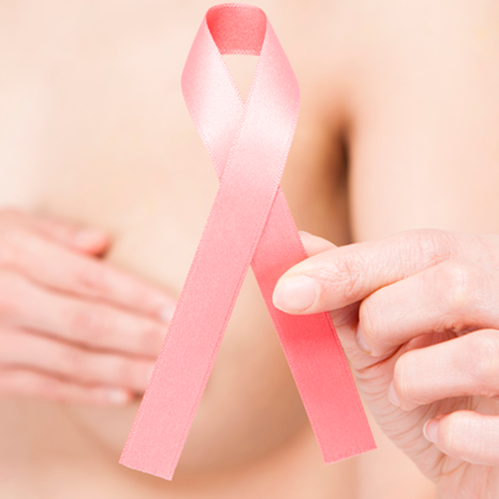 Pesquisa diz que câncer de mama em estágio inicial dispensa quimioterapia.