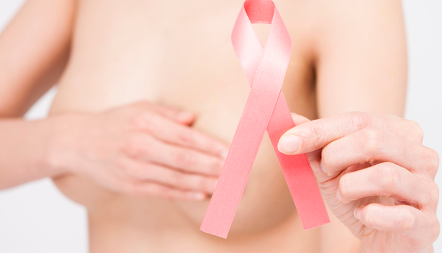 Pesquisa diz que câncer de mama em estágio inicial dispensa quimioterapia.